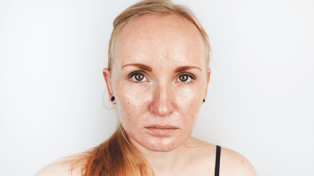 אישה עם סוג עור יבש